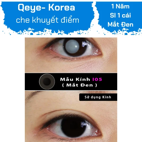 Lens che khuyết điểm ( Mắt đen )